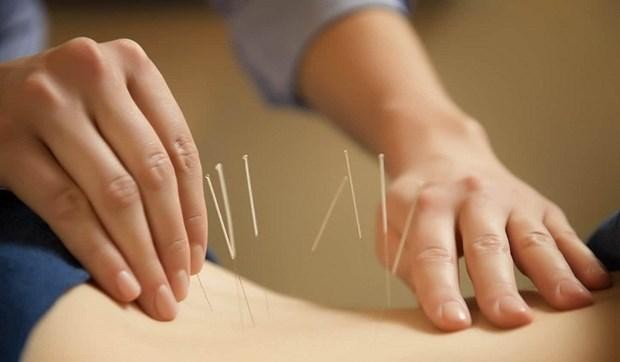 Acupuncture is one of traditional healing methods. (Photo: VNA) 