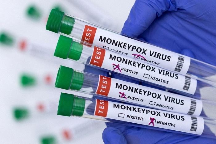 Canada has confirmed 1,435 cases of monkeypox, including 42 hospitalisations, the Public Health Agency of Canada said on Friday.