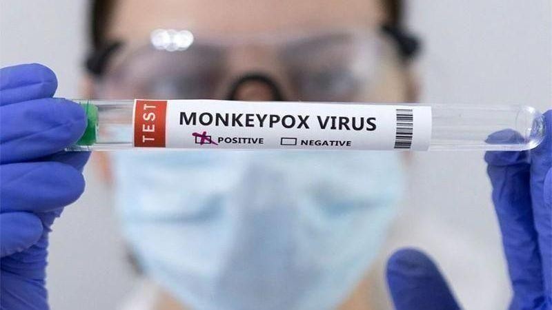Test tubes labelled "Monkeypox virus positive" (Photo: Reuters)