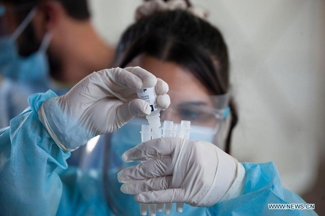 A medical worker wearing protective shield prepares the swab sample of COVID-19 rapid test in Nicosia, Cyprus, Feb. 5, 2021. (Photo: Xinhua)